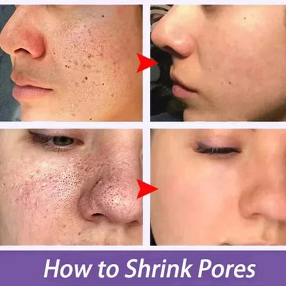 Lactic Acid Pore Minimizing Serum