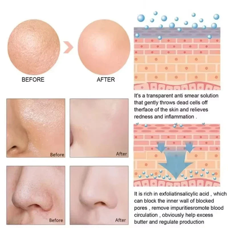 Lactic Acid Pore Minimizing Serum