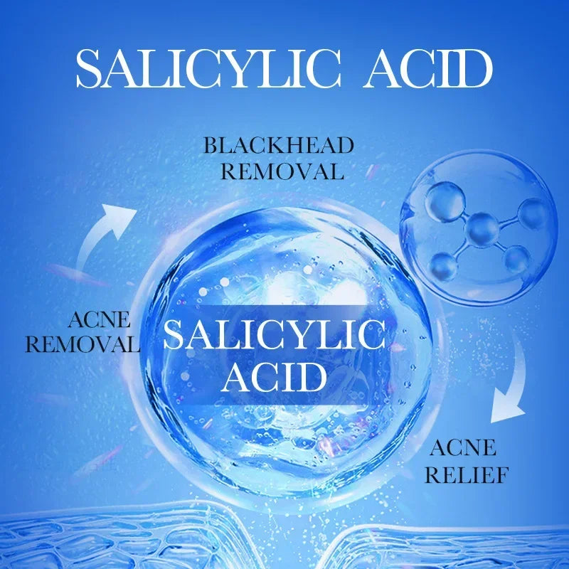 Salicylic Acid Acne Removal Face Cream
